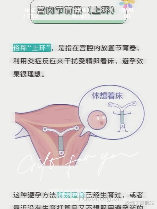 带环受孕可以生吗