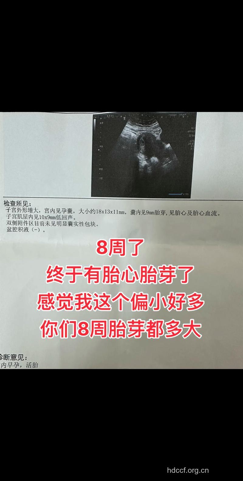怀孕8周
