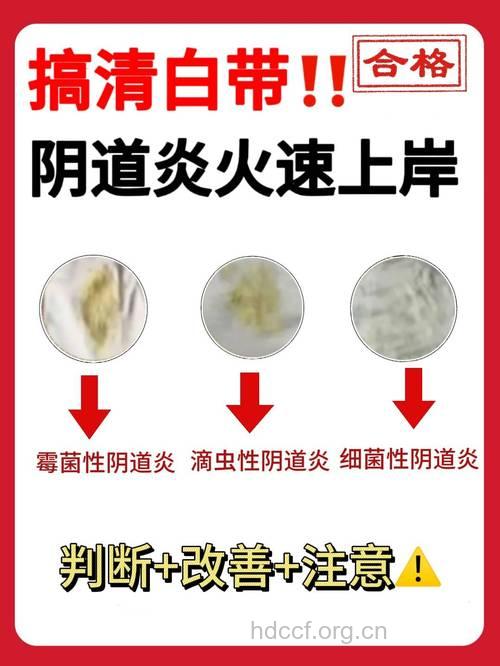 女性白带过少容易感染阴道炎