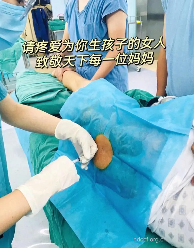 剖腹产后插尿管的那些事情