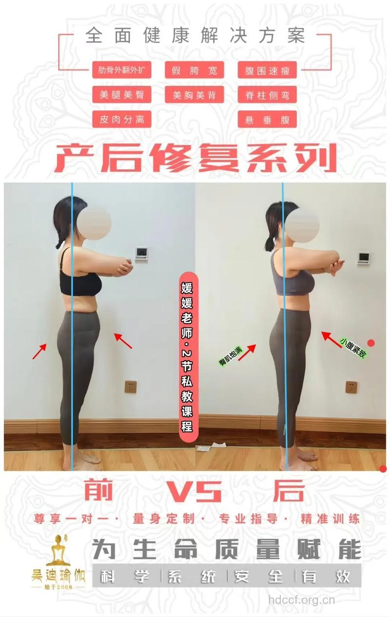 自然产和剖腹产的产后恢复有哪些不同