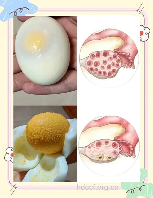 产后妊娠纹 鸡蛋内皮来帮忙