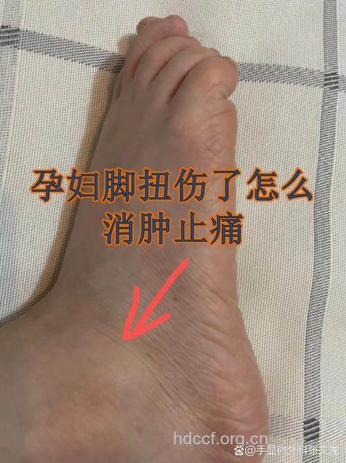 孕期脚心疼