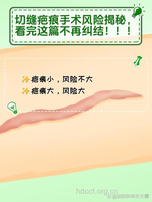 疤痕治疗的手术风险大不大？