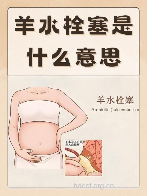 什么是羊水栓塞