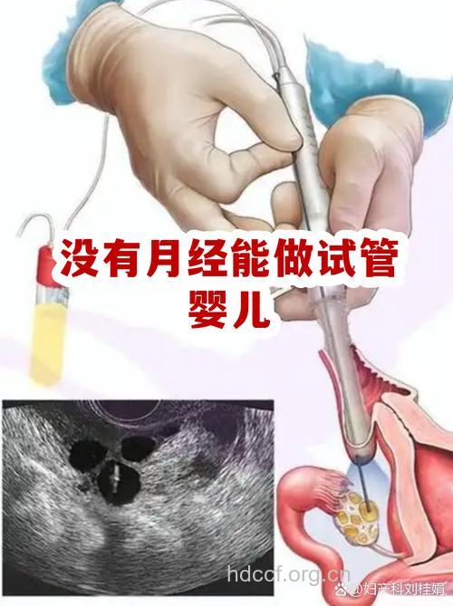 手机放在哪里影响受孕