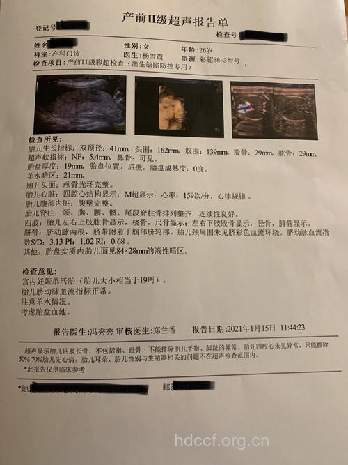 二维彩超检查什么