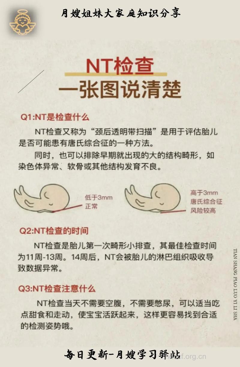 做NT检查必要性