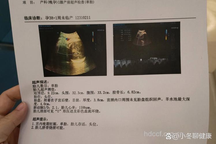孕38周产检