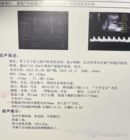 孕25周孕检
