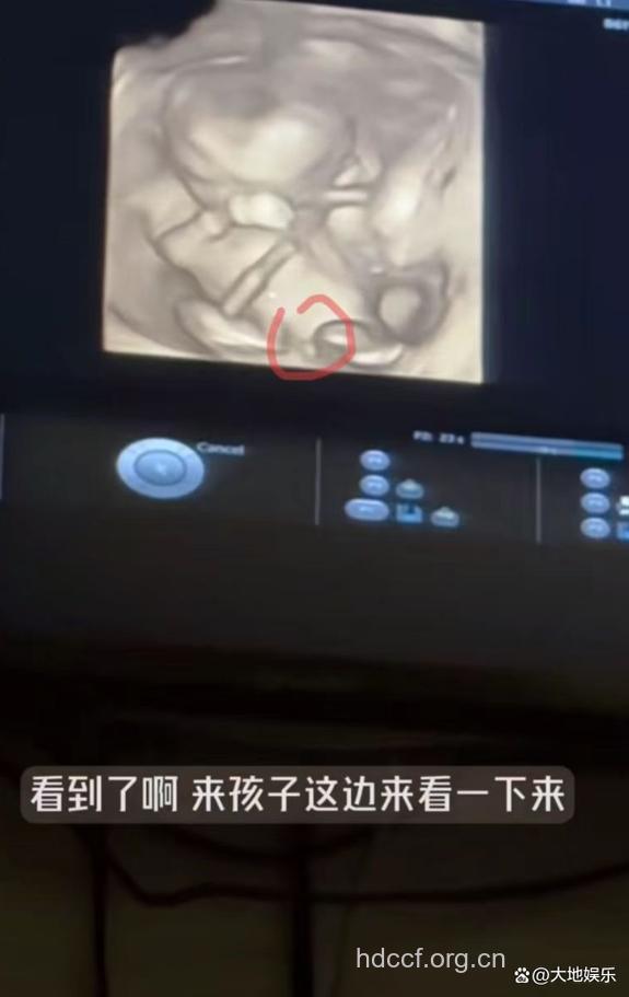 孕17周产检