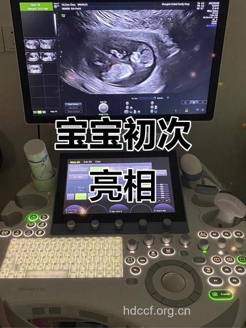 孕12周产检