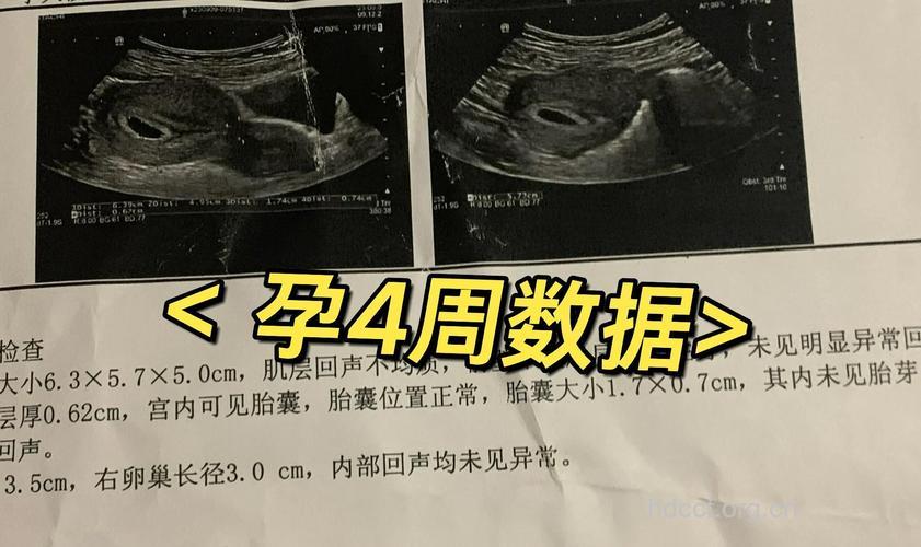 孕4周产检