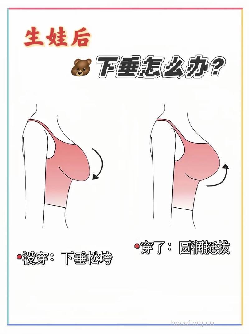 产后胸部为什么走形