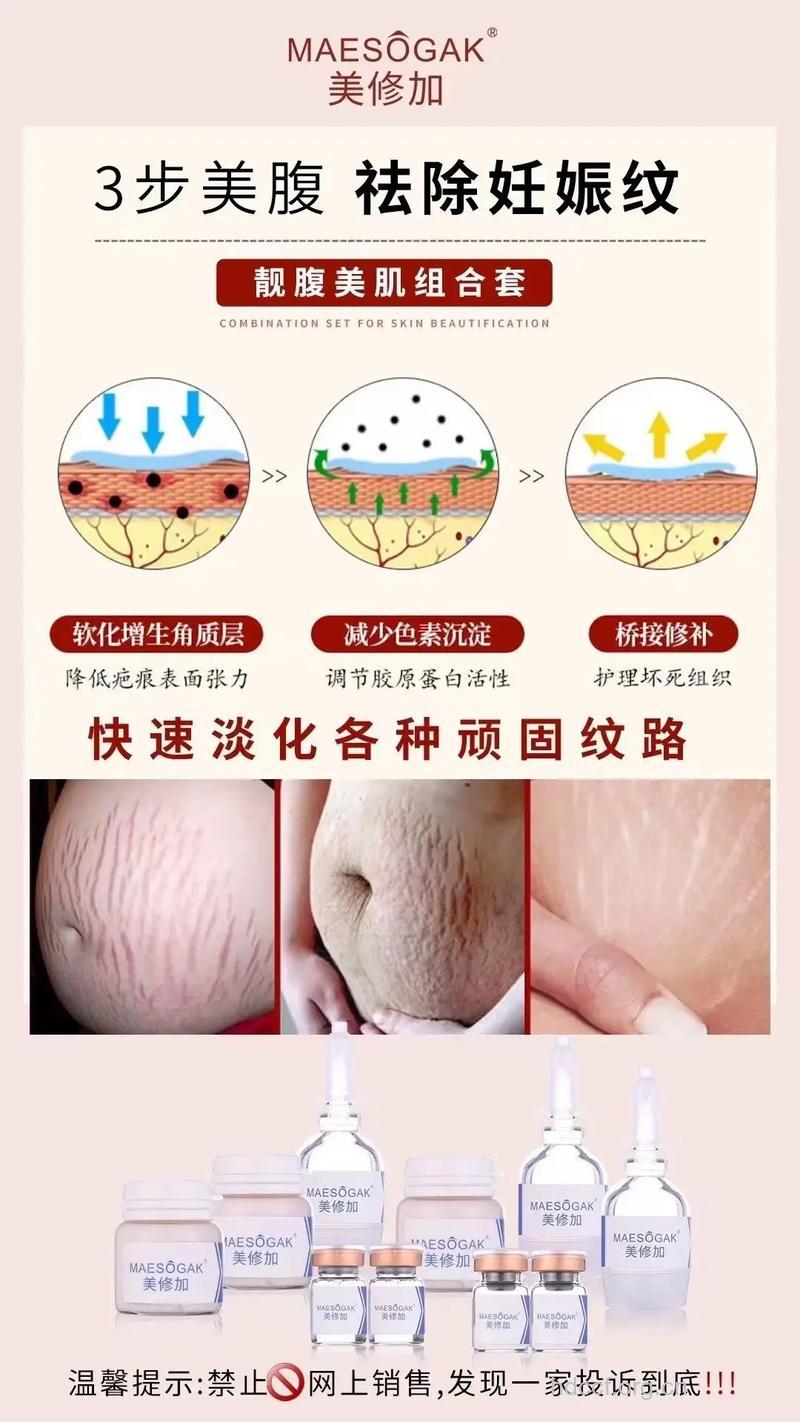 产后妊娠纹该怎么修复