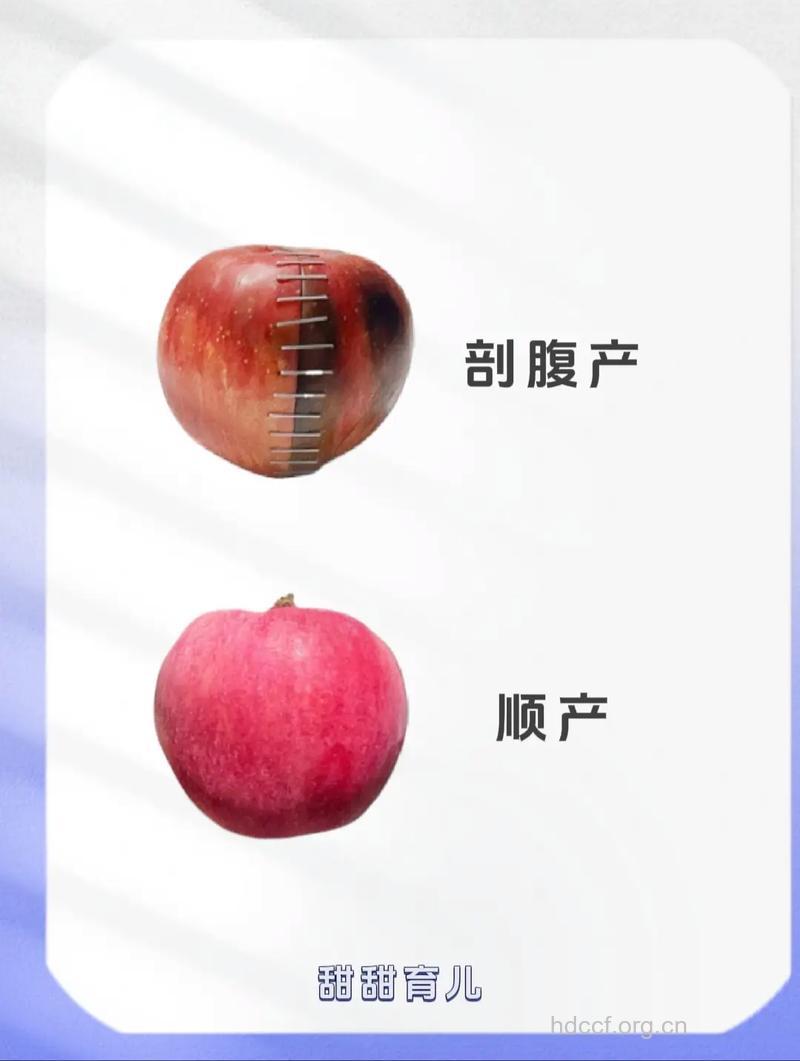 剖腹产和顺产产后有哪些恢复区别