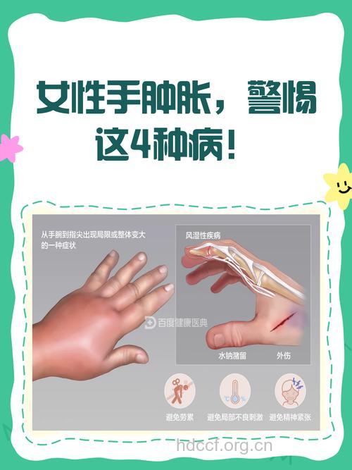 产后10天惹上妈妈手 这个病你也要小心