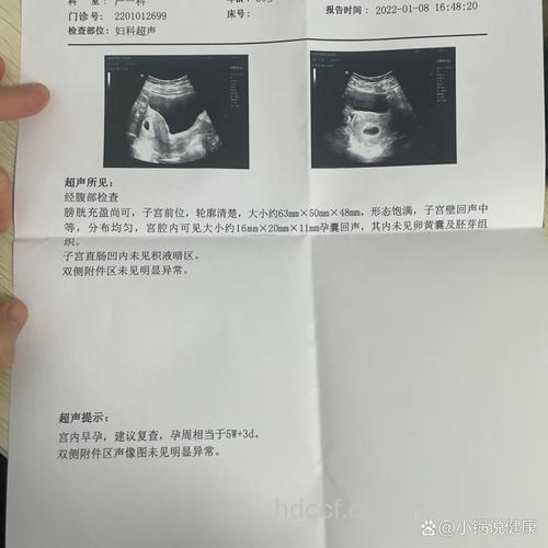 宫内早孕