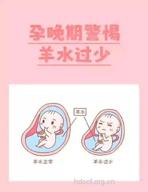 羊水偏少