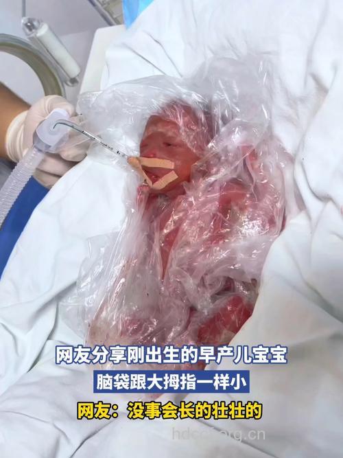早产症状