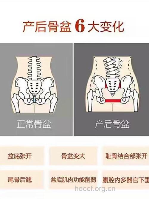 剖腹产后遗症