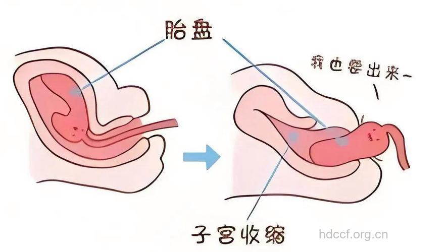 第三产程