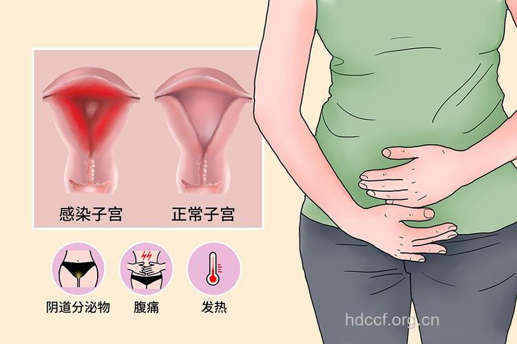 产后哪些部位容易感染