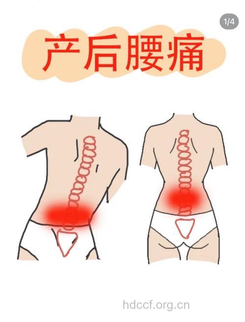 产后为什么会腰腿疼痛