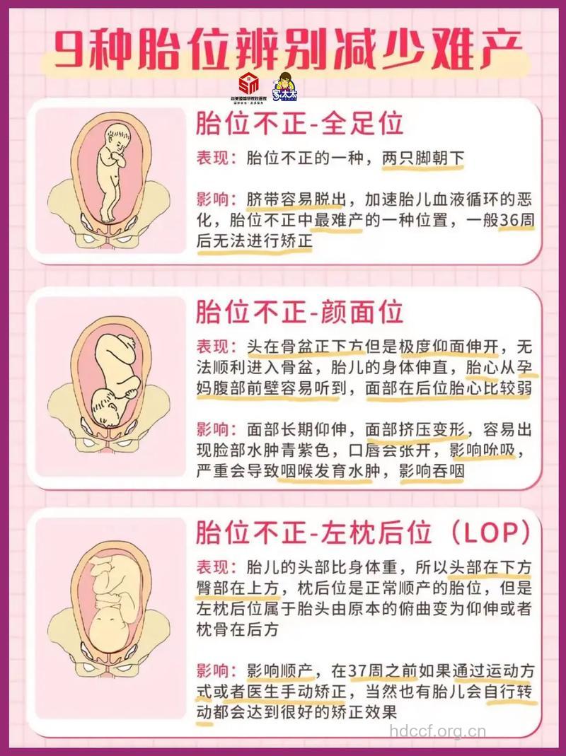 胎位不正的原因 胎位不正要如何纠正
