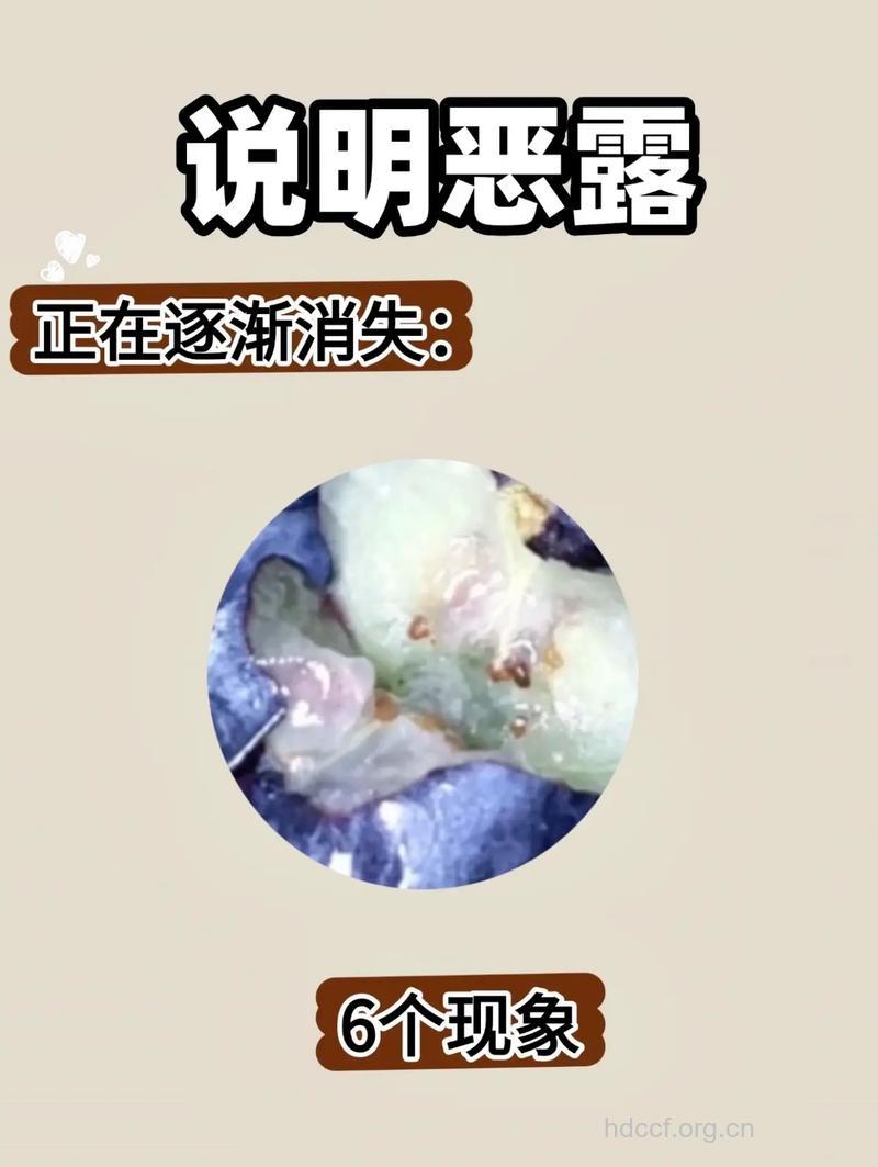 剖腹产的恶露情况