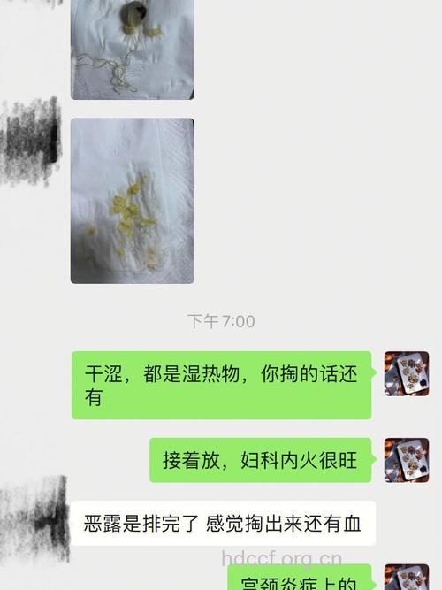 产后恶露不尽