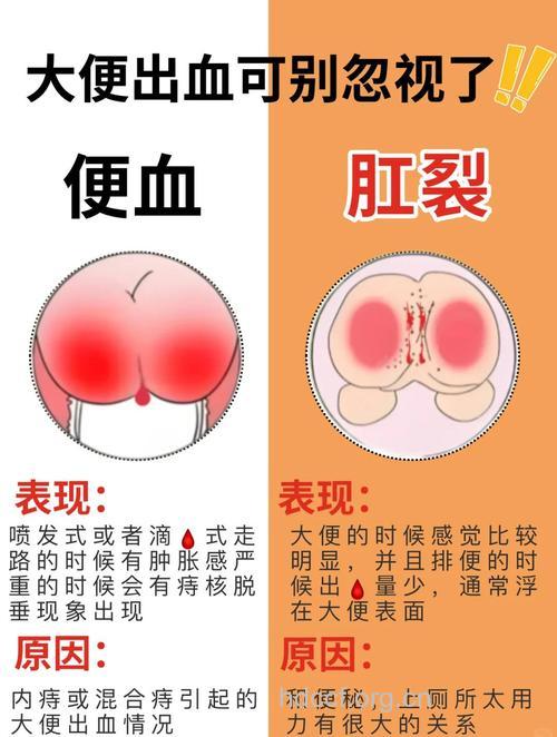 产后便秘出血怎么办好