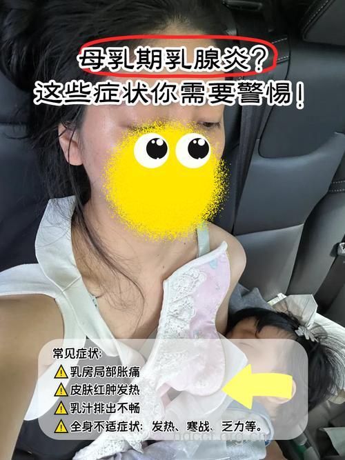 产后乳房疾病
