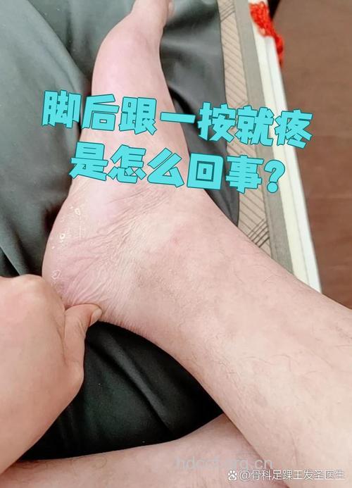 月子病脚后跟疼