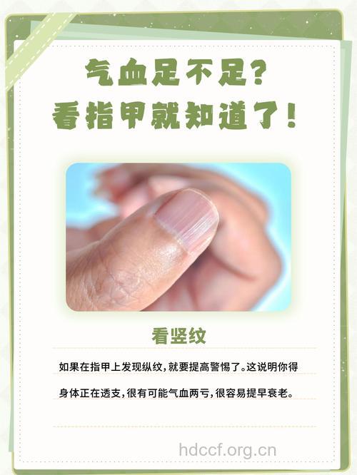 怎么从指甲看血气不足