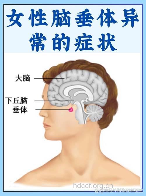 垂体前叶功能减退症