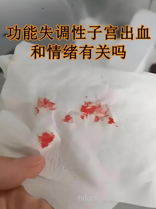 产后功能失调性子宫出血