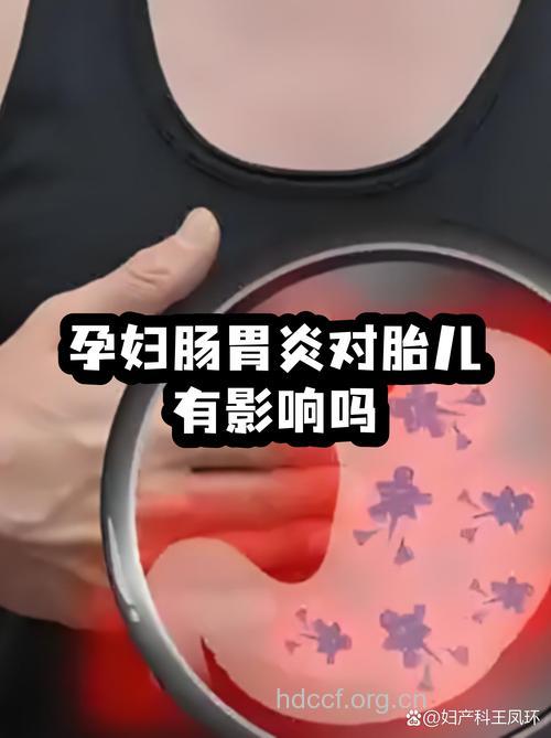 孕妇肠胃炎对胎儿有影响吗 如何正确处理