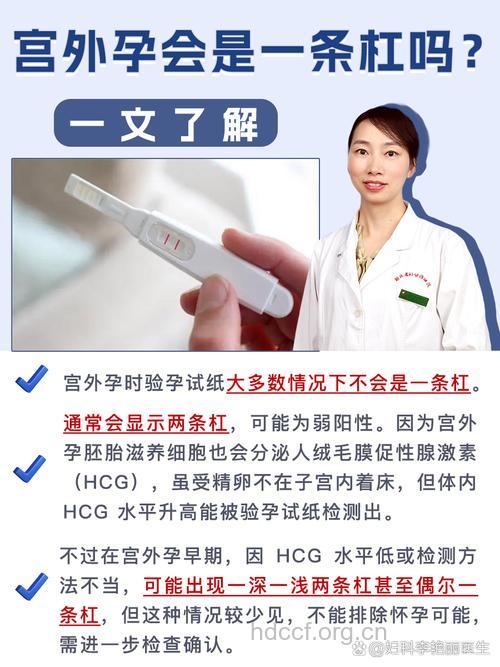 宫外孕早期能查出来吗