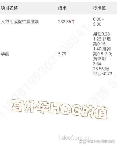 HCG值多少是宫外孕