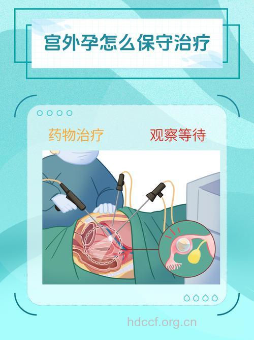 宫外孕可采用哪种疗法