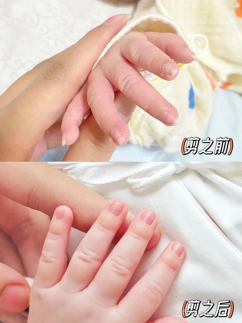新生儿剪指甲