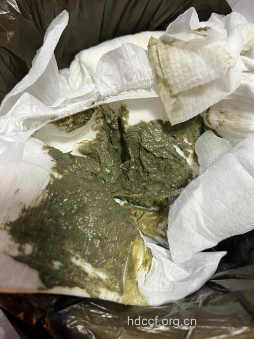 新生儿大便发绿