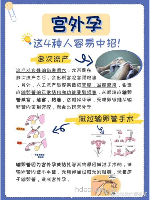 有宫外孕史的人可能更容易得宫外孕