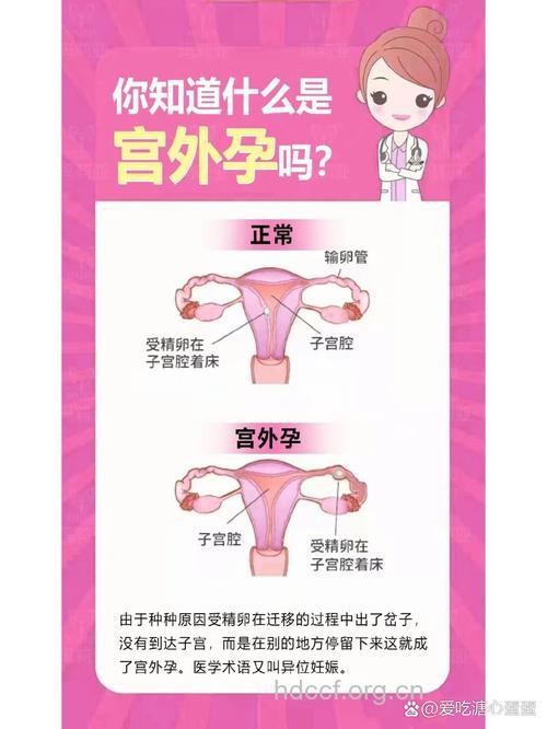 宫外孕的原因是什么呢