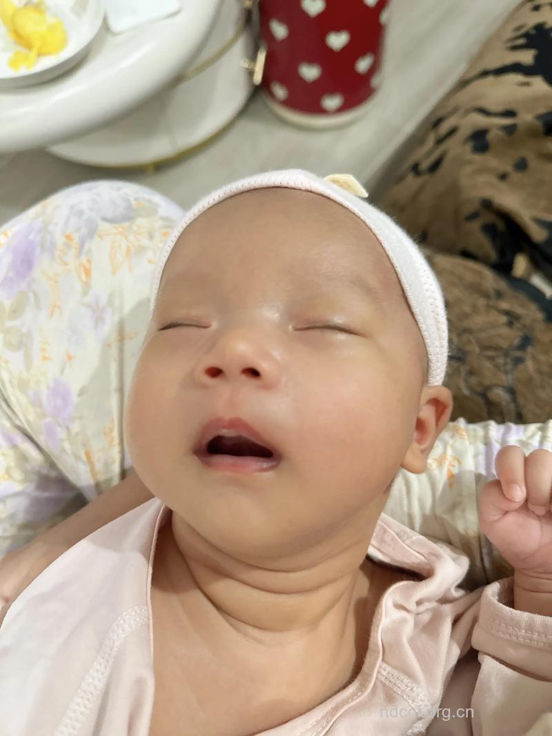 新生儿睡眠惊厥