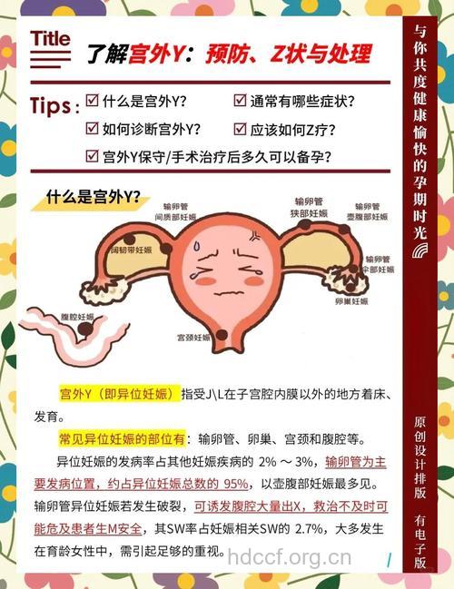宫外孕的常识知多少