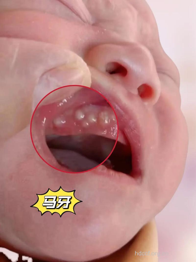 马牙