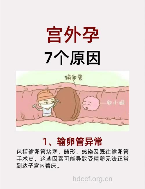 宫外孕究竟有多可怕