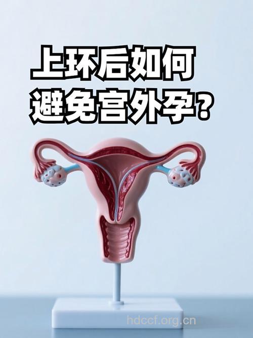 为什么避孕环会导致宫外孕